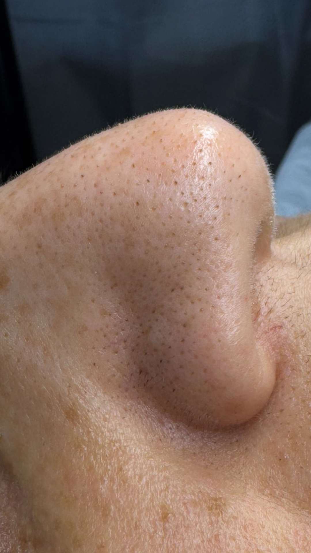 Après soin nez pores resserrés