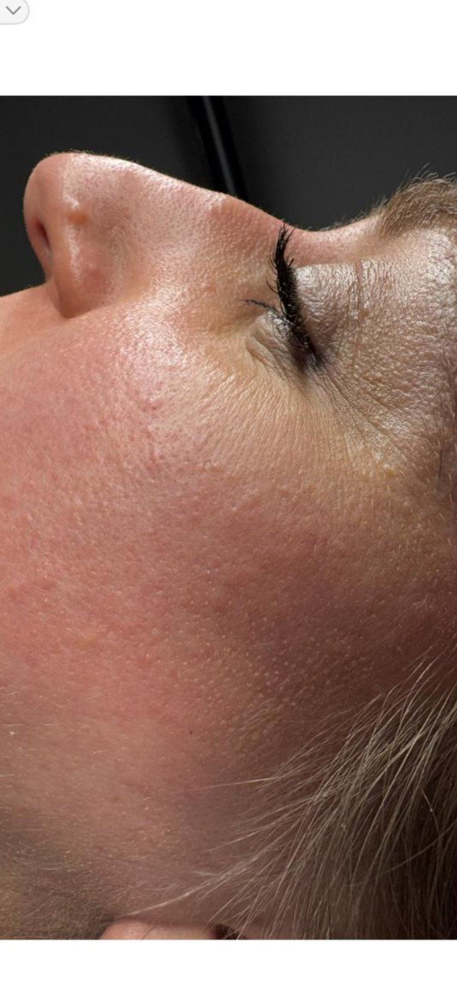 Avant soin Hydr'Active