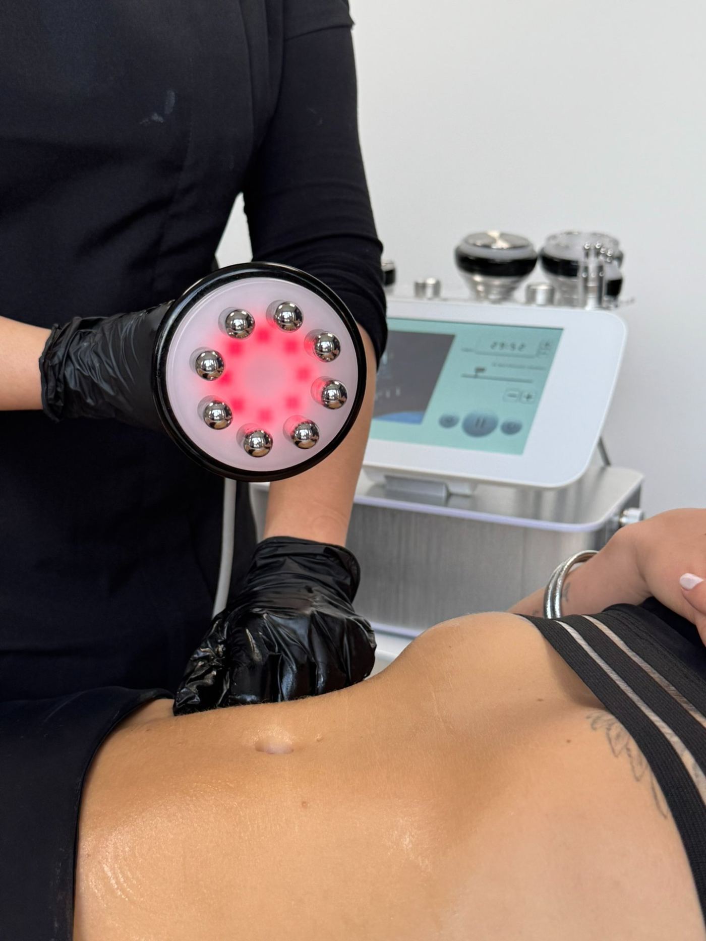 Cavitation radiofréquence corps minceur à Groslay (95) — Laser Ligne