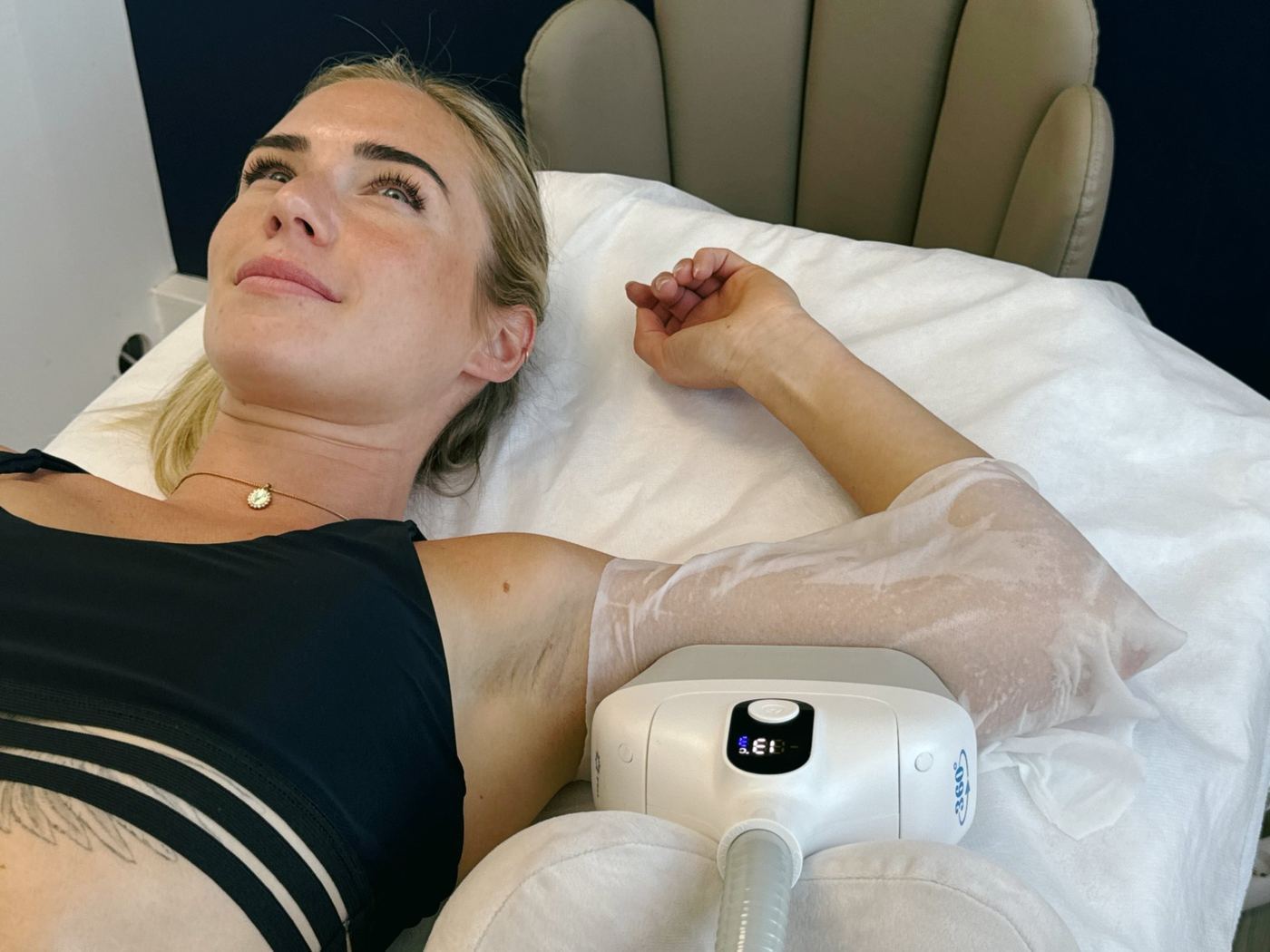 Cryolipolyse Laser Ligne Groslay aisselle