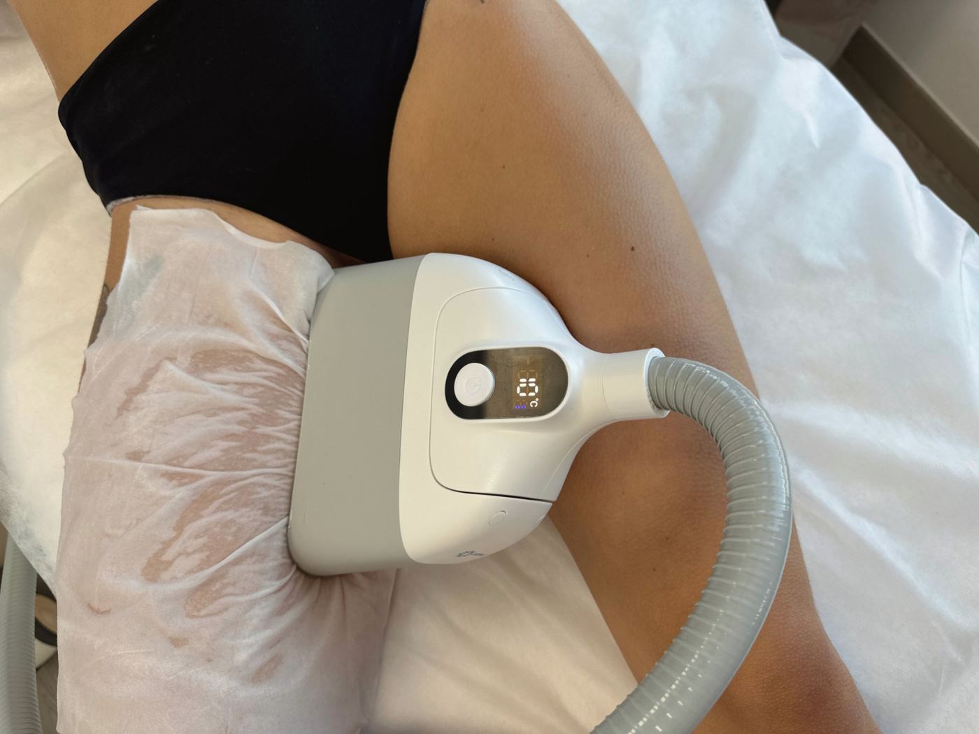 Cryolipolyse flanc Laser Ligne Groslay