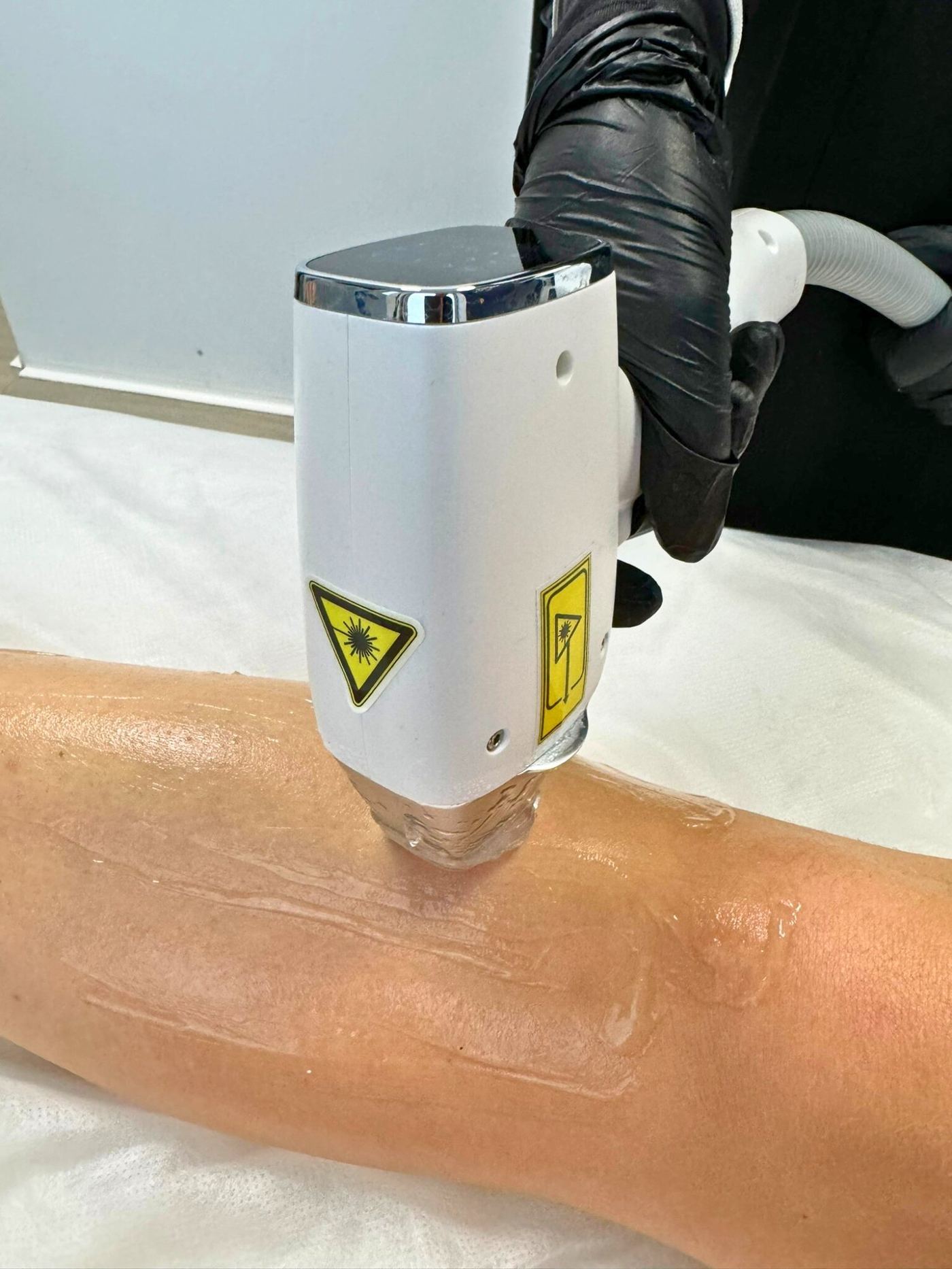 Épilation laser jambe gel Ténor Diode Groslay 95 — Laser Ligne