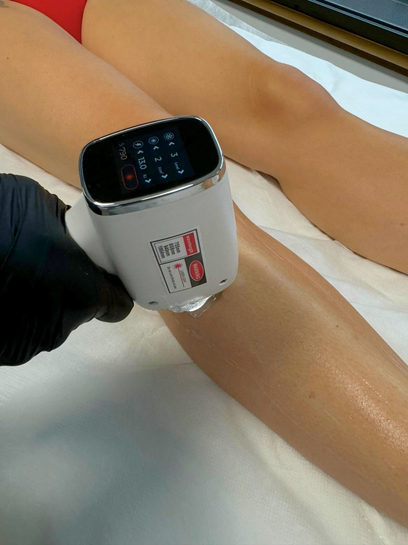 Épilation laser jambe genou Laser Ligne