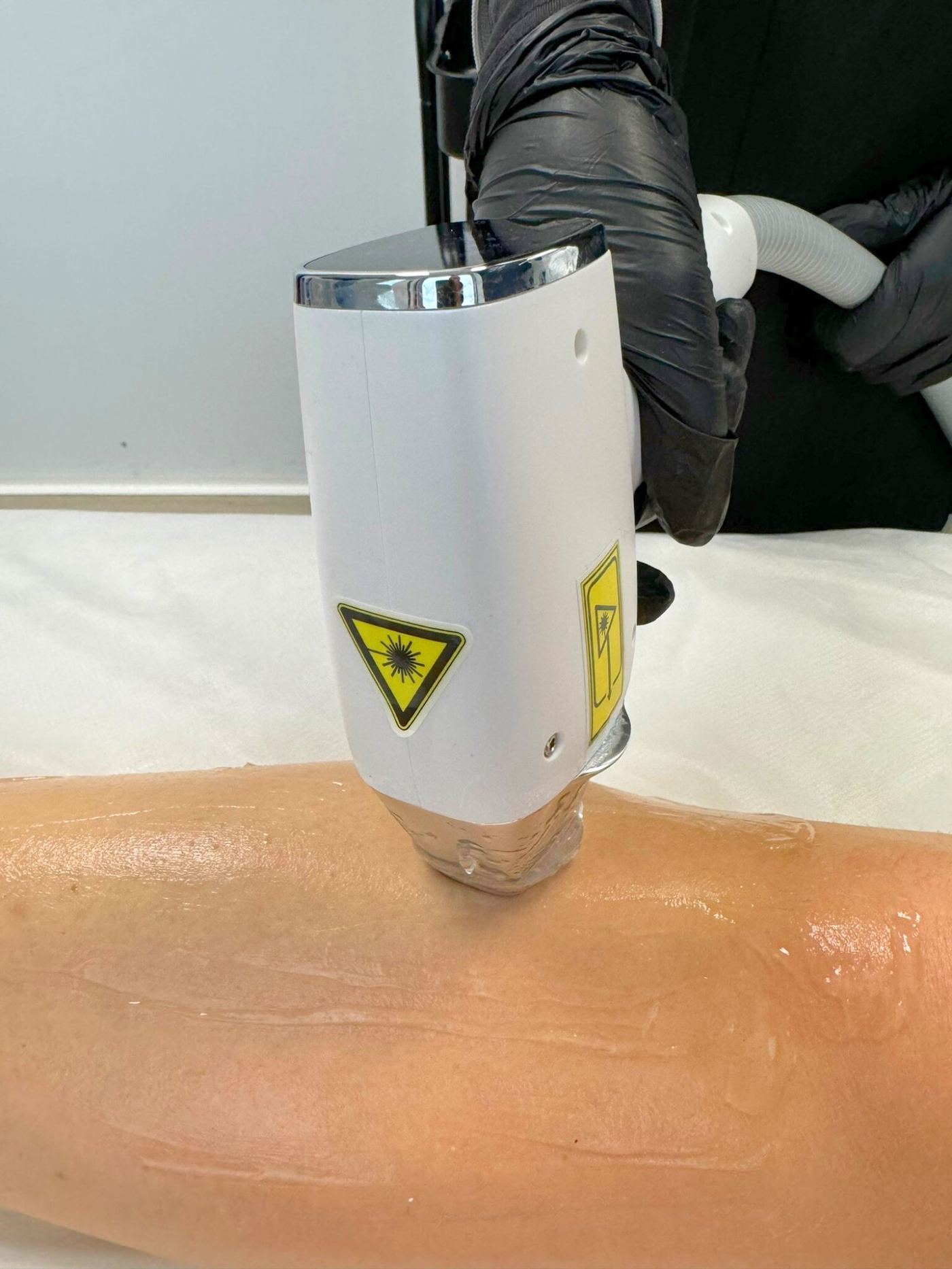 Épilation laser jambe Laser Ligne 95