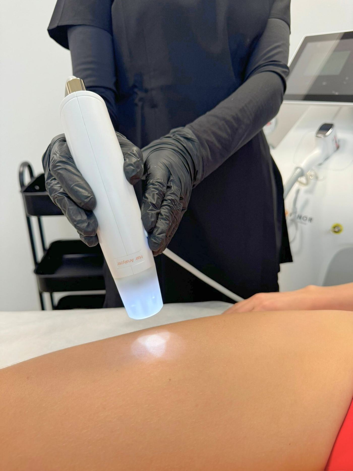 Épilation laser cuisse Laser Ligne