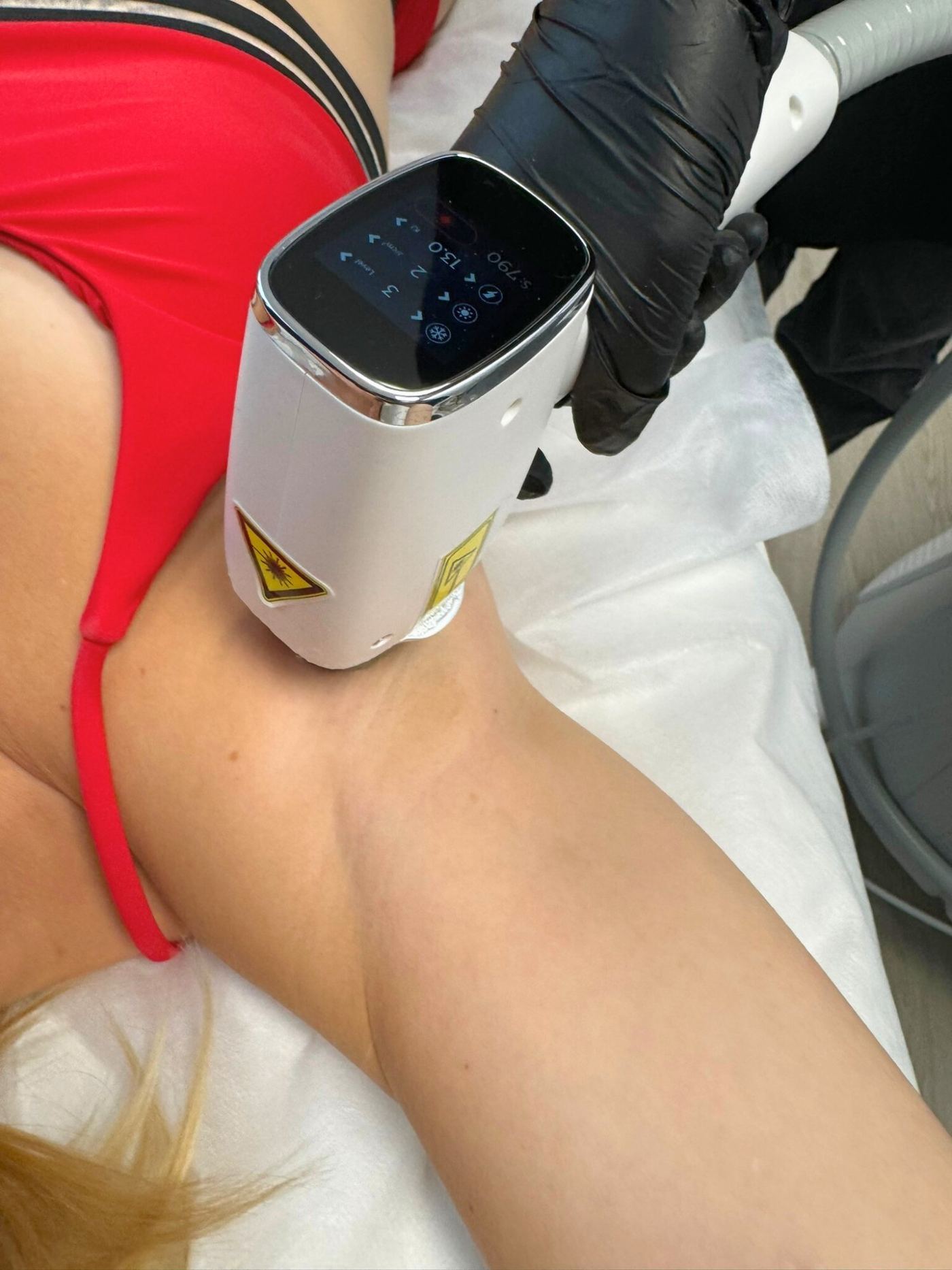 Épilation laser aisselle femme Laser Ligne