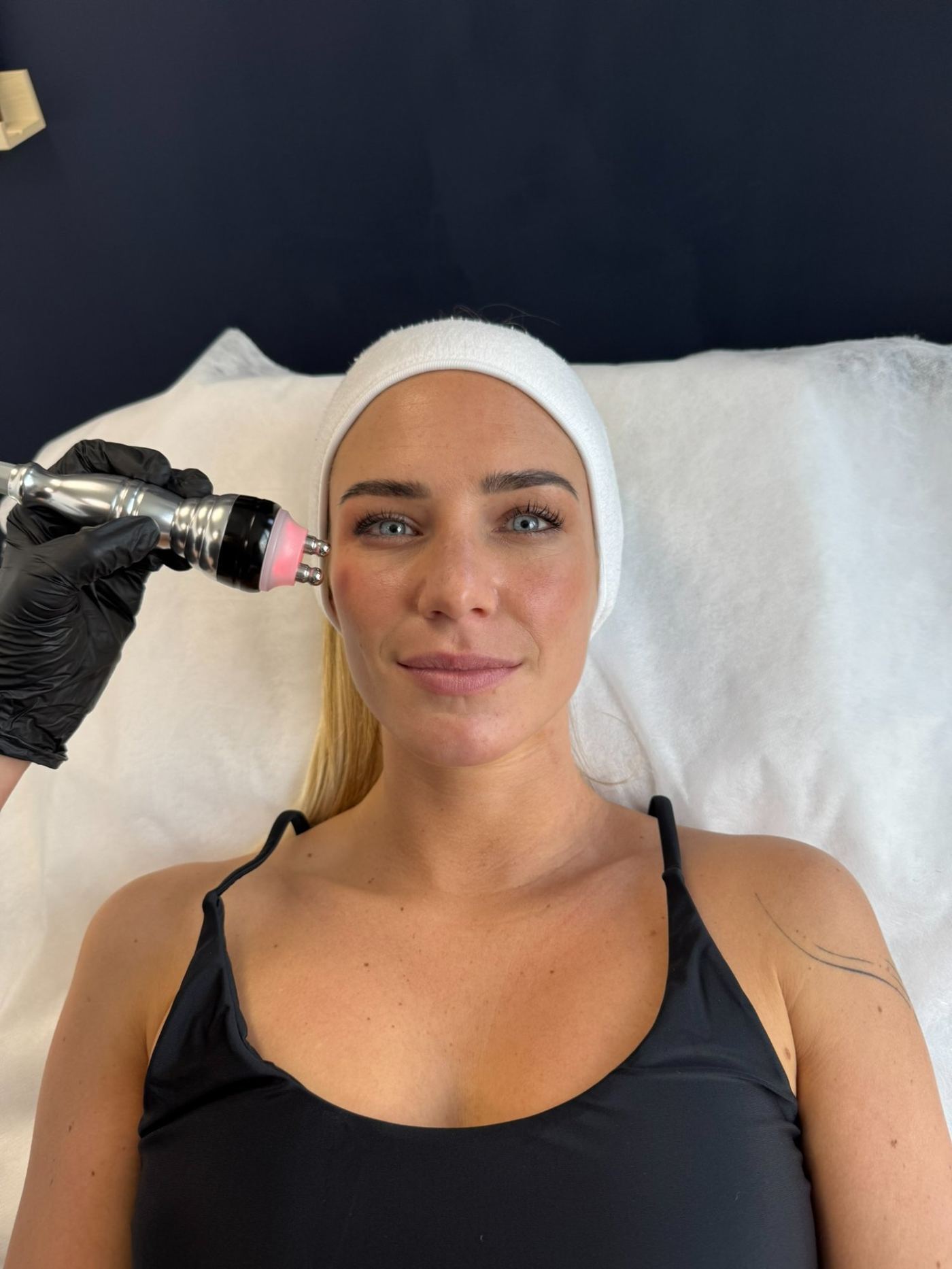 Soin anti-âge radiofréquence Laser Ligne