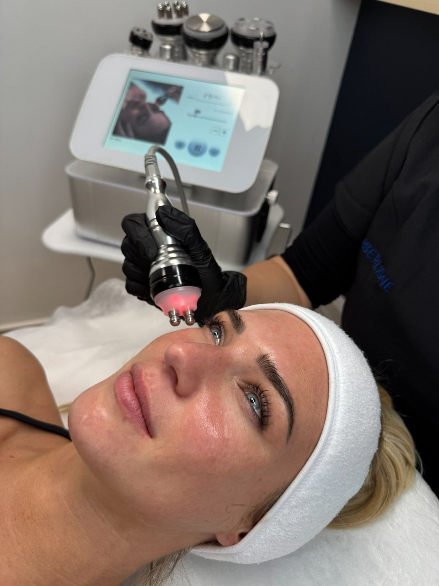 Radiofréquence visage Laser Ligne Groslay