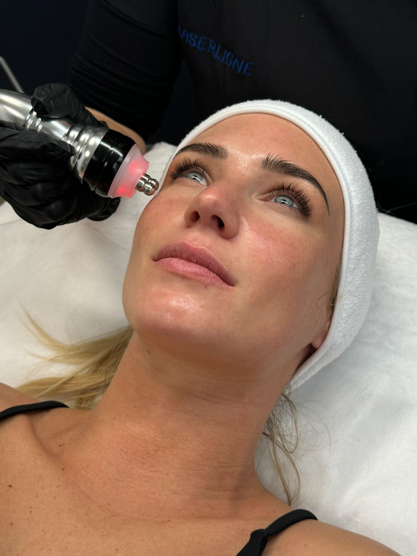 Lifting naturel Laser Ligne