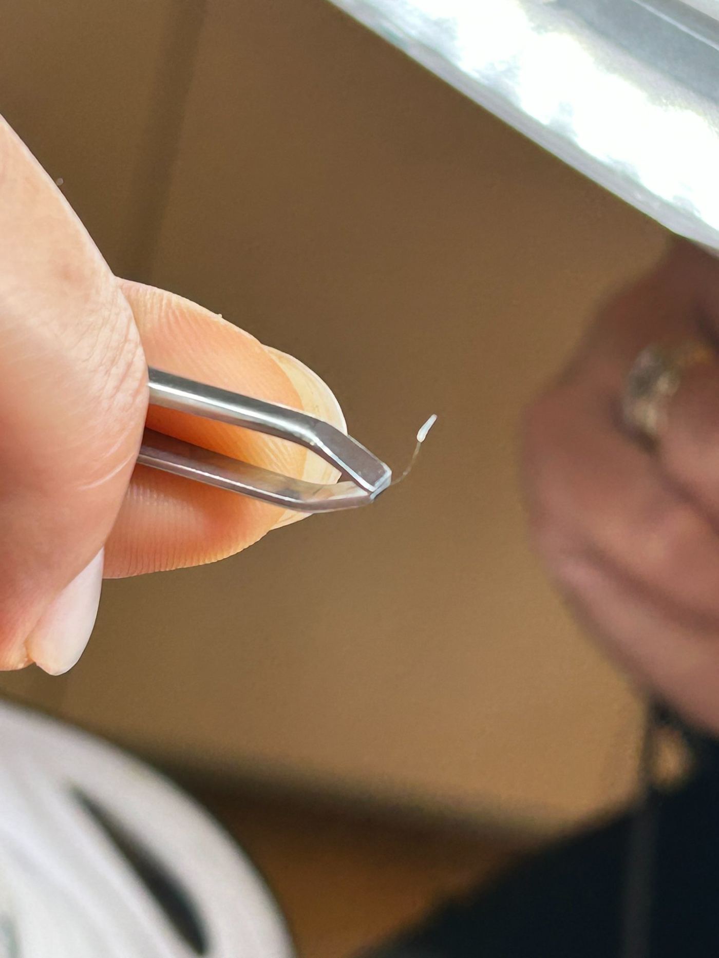 Extraction poil thermolyse pince Laser Ligne Groslay 95